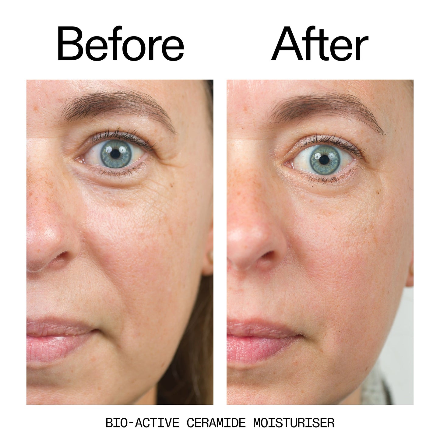 barrier-boosting-trio-f9 Bio-Active_Before_After_2000x2000_600947b4-e8c5-425a-9155-fc15bc83aa12.jpg