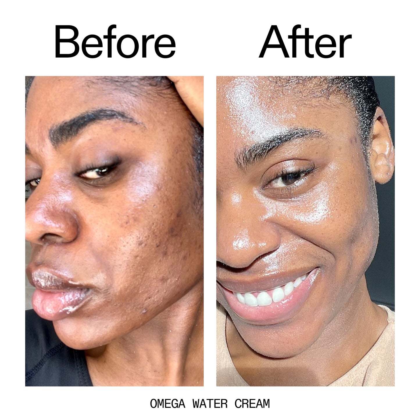 hydrating-cleanser-and-moisturizer-duo-s7 Omega_Water_Cream_Before_After_2000x2000_8e88278b-8c8d-48dc-ac77-4e98ebbd1b77.jpg