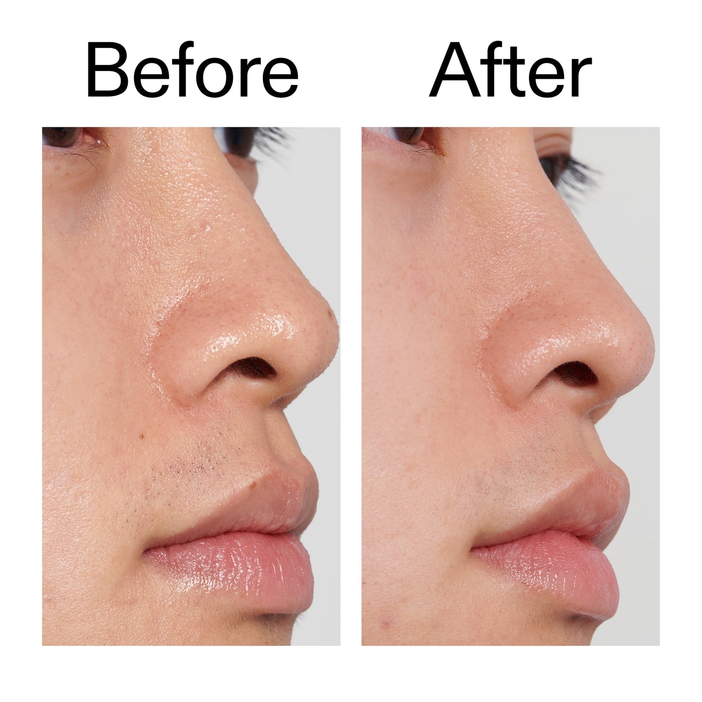 pha-toner-l5 PHA_Toner_Before_After_2000x2000_e3c10172-0150-4342-8b95-57417eaff50d.jpg