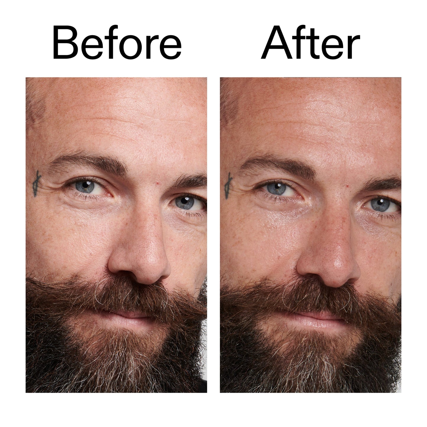 peptide-moisturizer-m6 Peptide_Moisturizer_Before_After_2000x2000_84623fe4-7b72-4f89-8e87-5edb6c752ac5.jpg