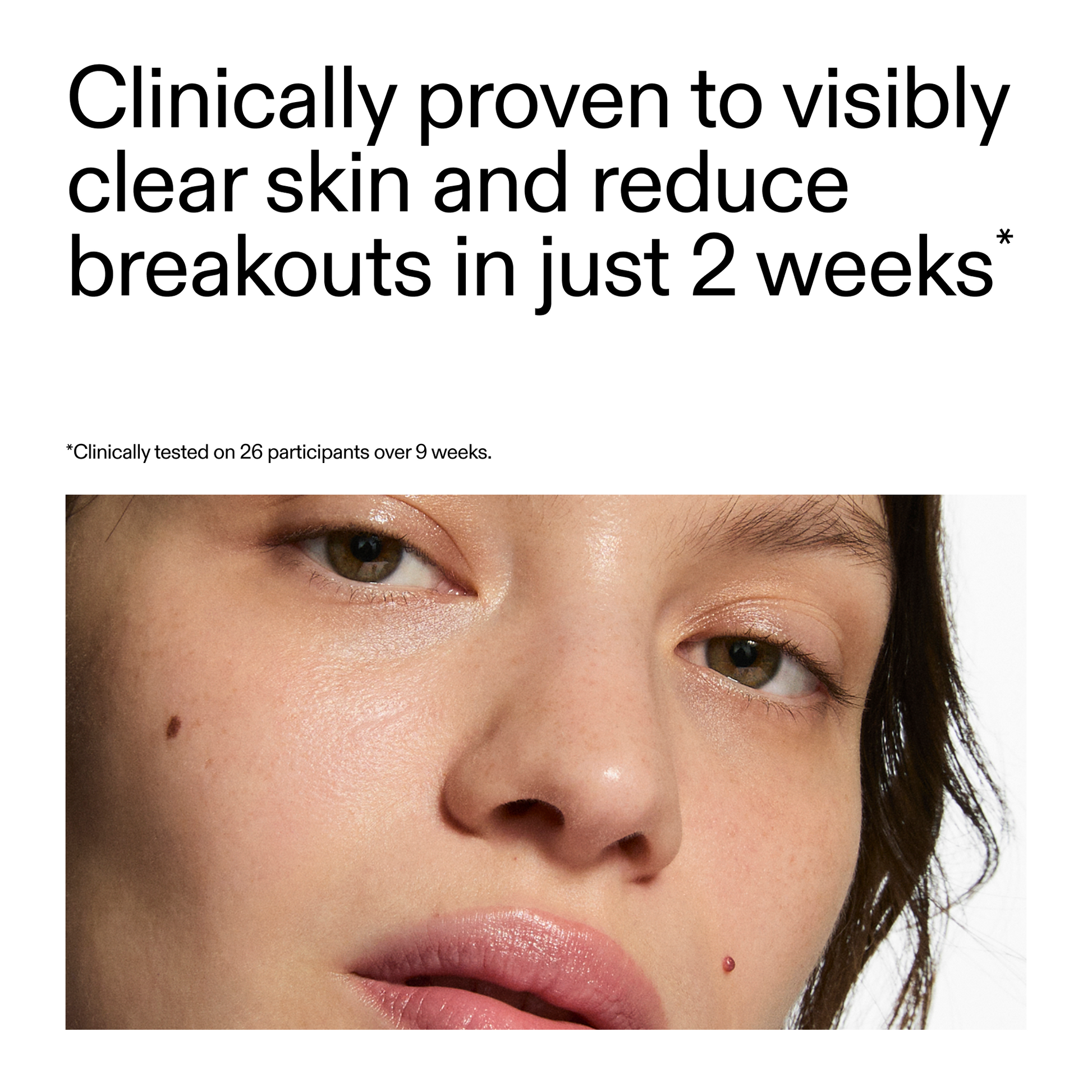 360-acne-clearing-serum-h1 360_Serum_Key_Claim.png