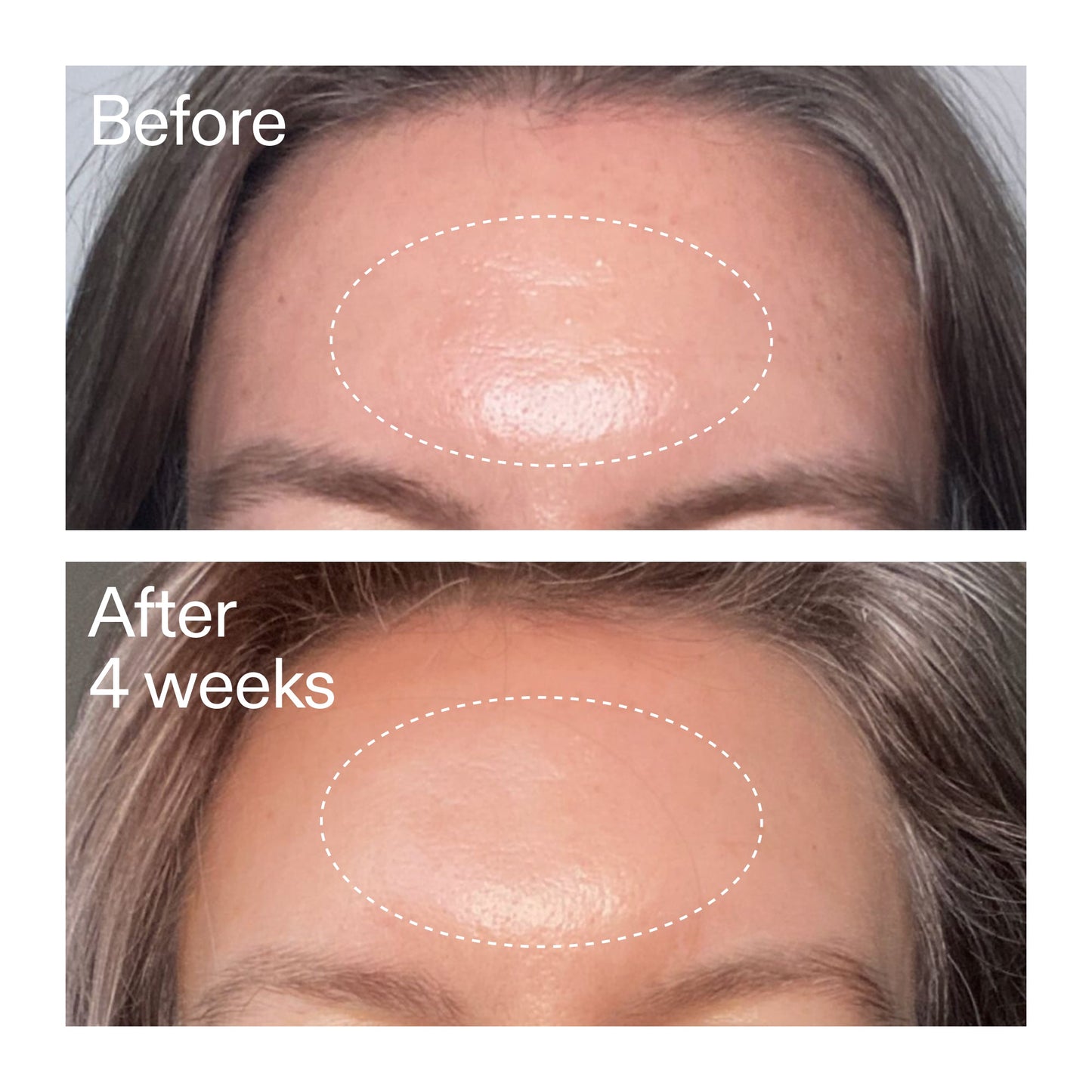 advanced-0-2-retinal-serum-duo-m3 AdvancedRetinal_BeforeAfter1_2000x2000_4e9c798a-f30e-45b8-a34a-7c4740f2f2cb.jpg