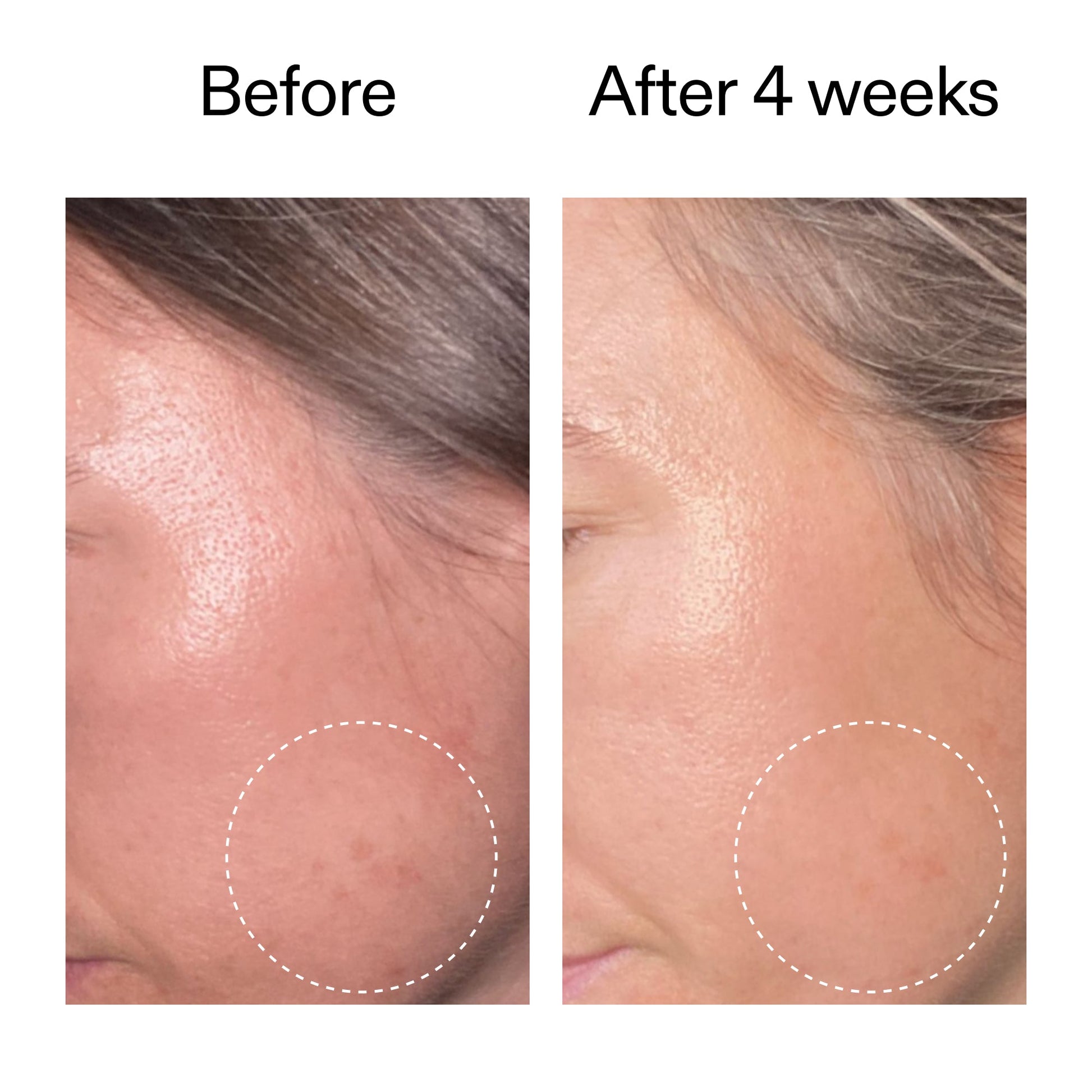 advanced-0-2-retinal-serum-q5 AdvancedRetinal_BeforeAfter2__2000x2000_62fb16bb-77ae-4d63-8500-88dbf847f4b9.jpg