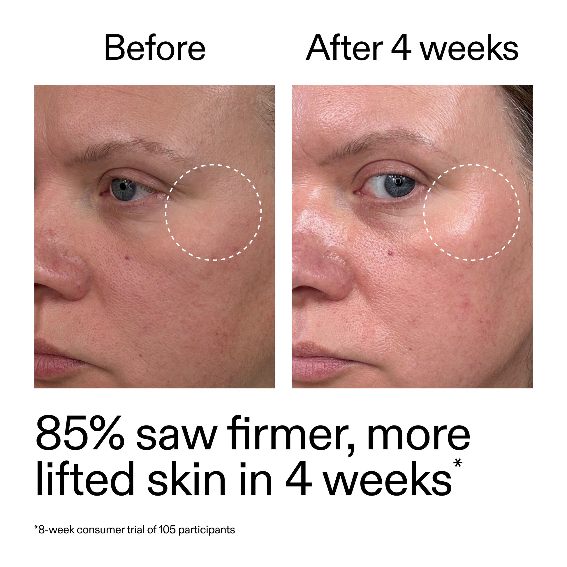 advanced-0-2-retinal-serum-duo-m3 AdvancedRetinal_BeforeAfter_Claim1_2000x2000_3a315aa8-f408-4b33-bbeb-0d9209f98404.jpg
