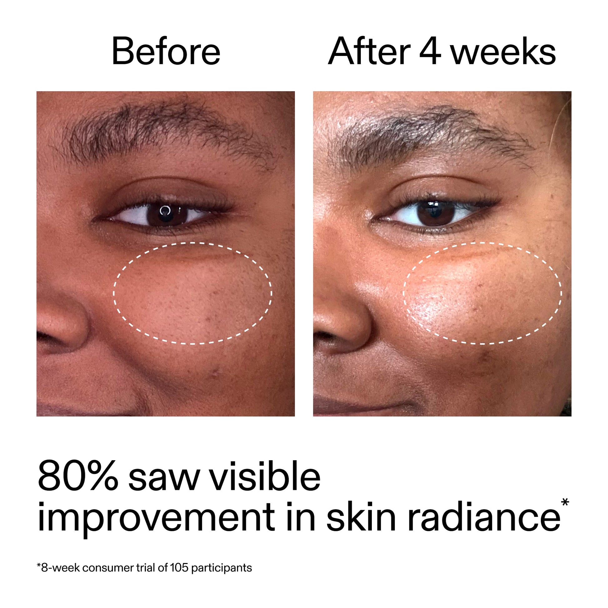advanced-0-2-retinal-serum-q5 AdvancedRetinal_BeforeAfter_Claim2_2000x2000_39d11e3d-eda9-44ec-ab32-2903b1a368bd.jpg