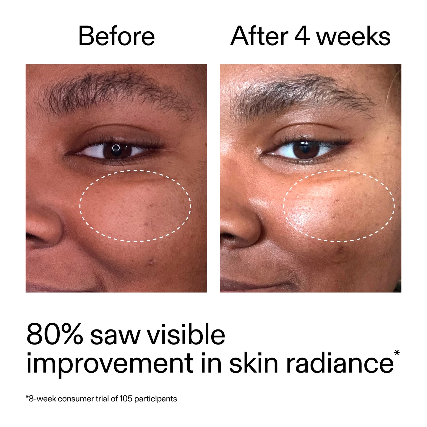 advanced-0-2-retinal-serum-duo-m3 AdvancedRetinal_BeforeAfter_Claim2_2000x2000_681b621d-8d44-4d44-9a40-89244f9b2e53.jpg