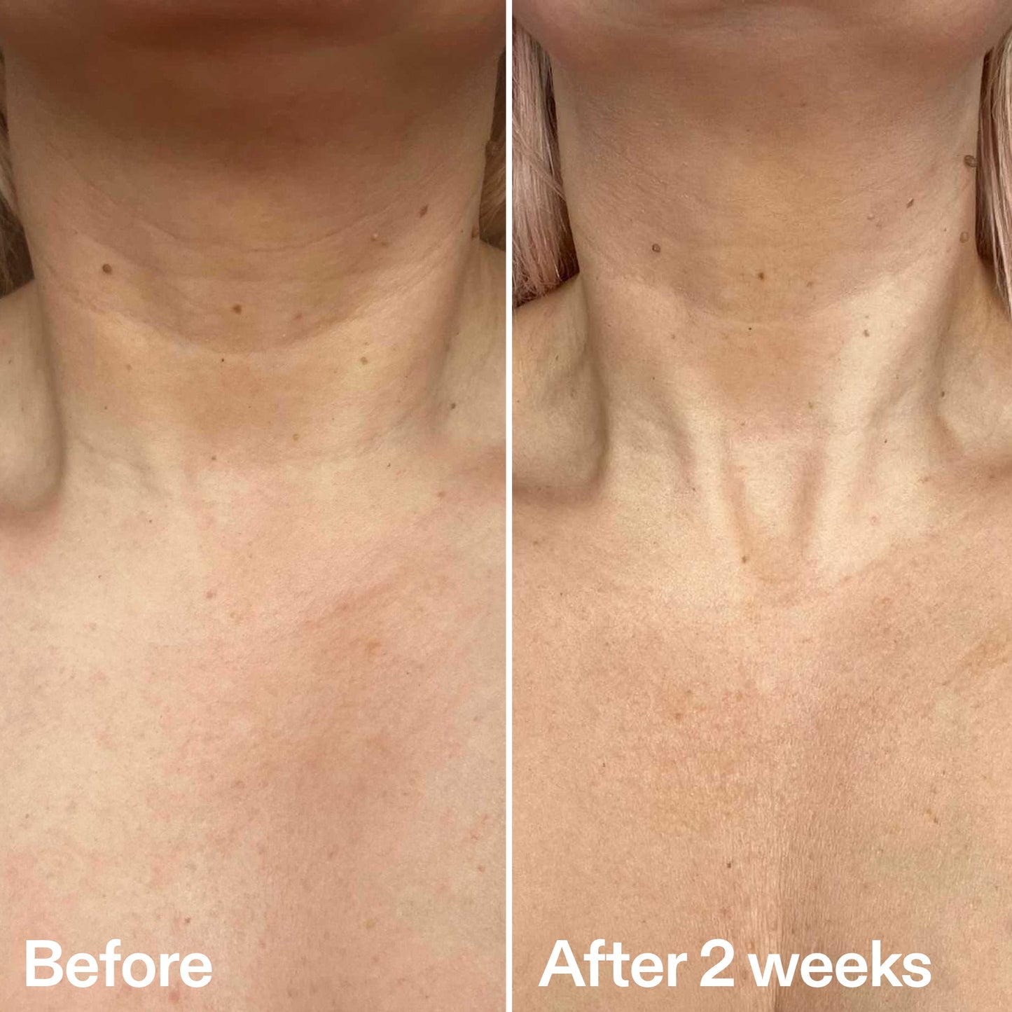 bio-active-neck-lift-stick-h7 B_A_2.jpg