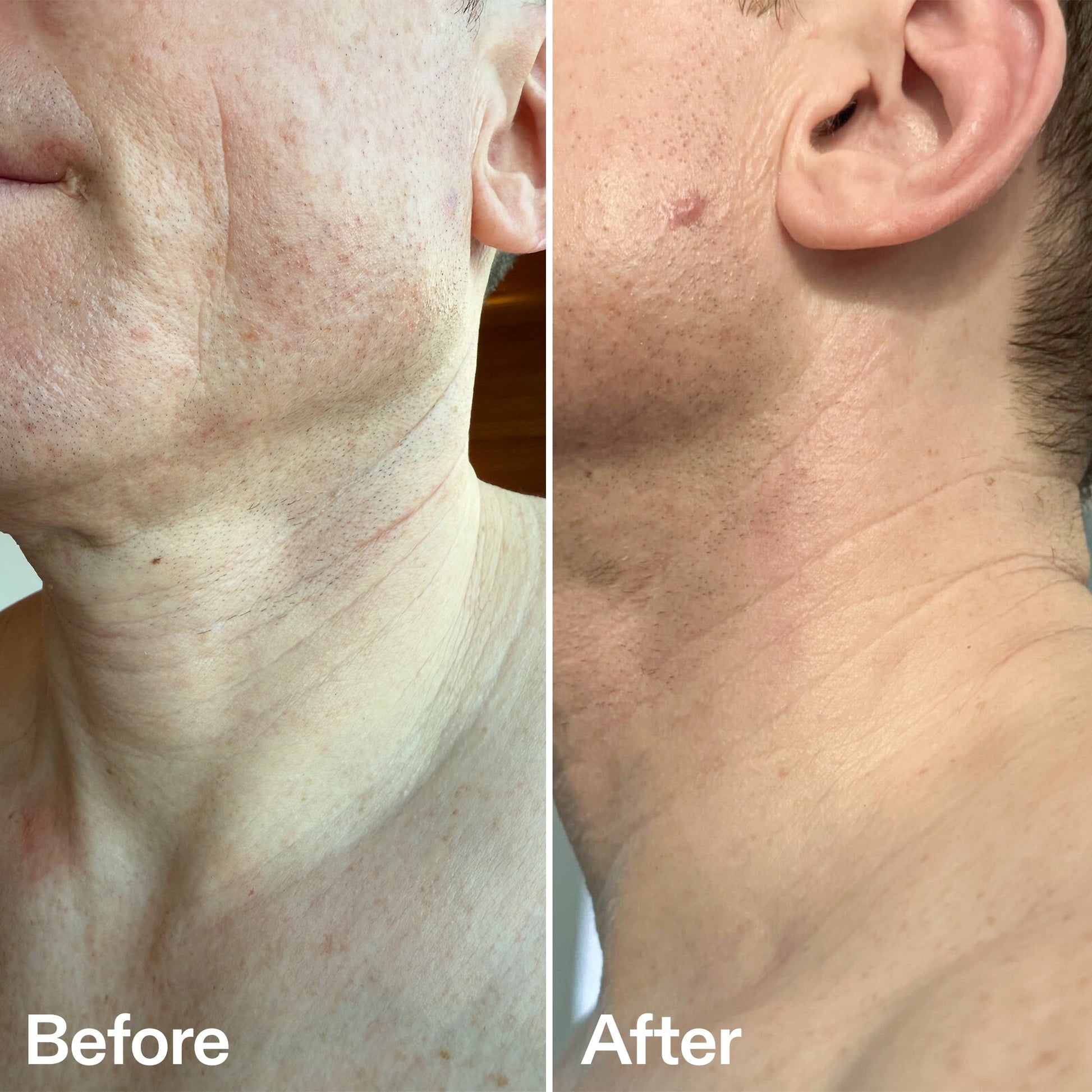 bio-active-neck-lift-stick-h7 B_A_afa2743e-b8e2-4504-92f4-e281cb6cf759.jpg