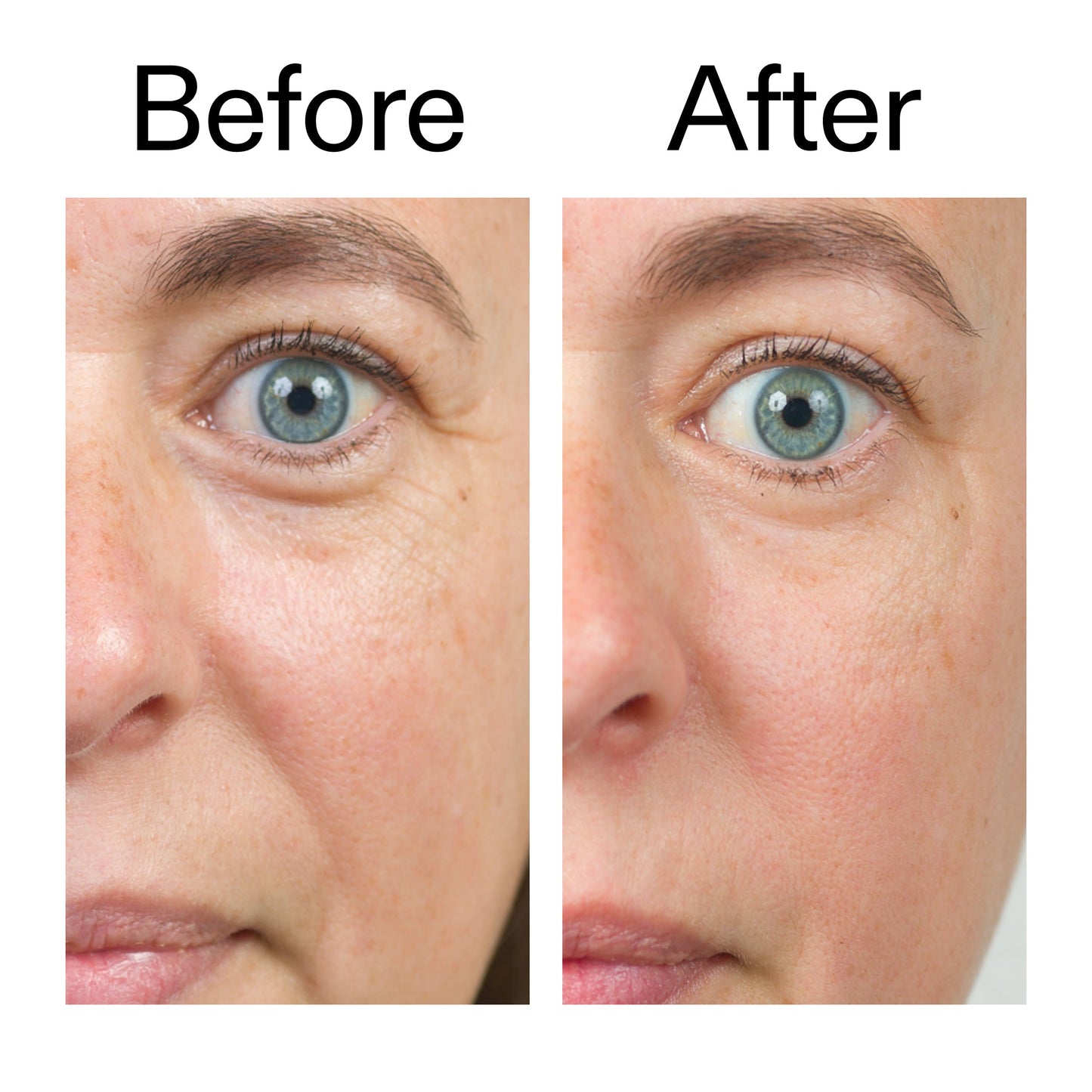bio-active-ceramide-moisturizer-n9 Bio-Active_Before_After_2000x2000_566e5a9e-135e-417a-8242-b44e5fa35463.jpg