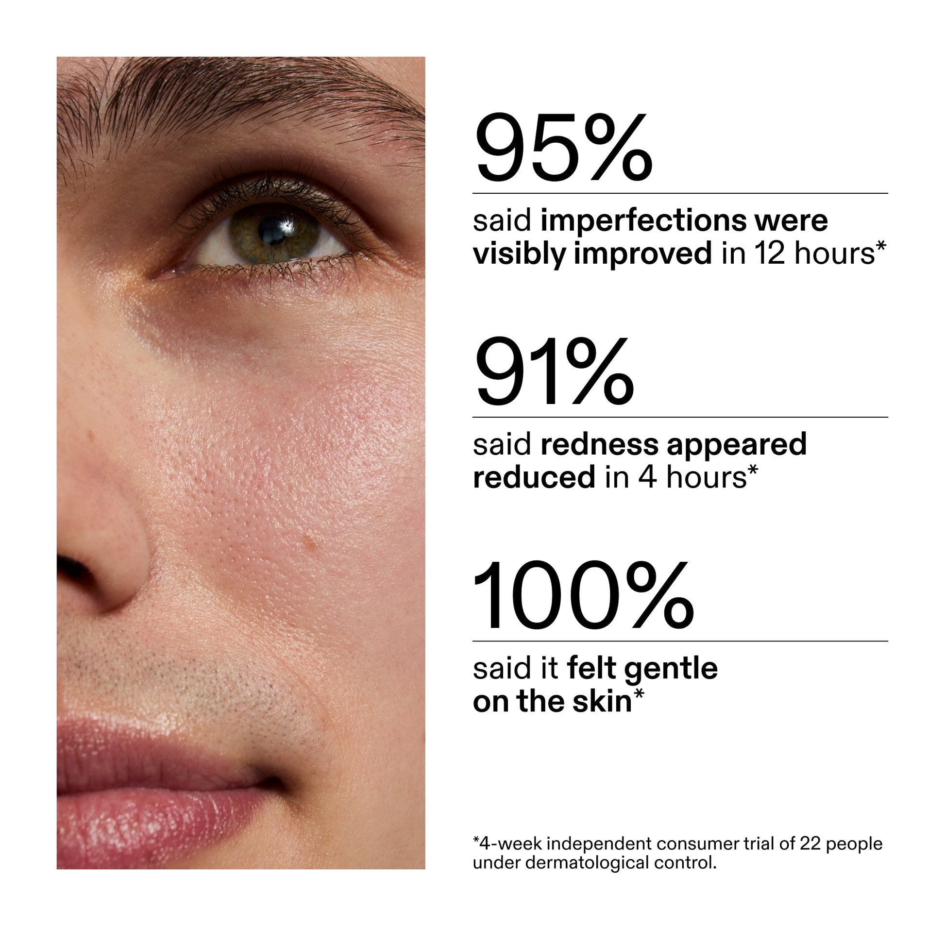 succinic-acid-acne-treatment-b6 CA_Succinic_Acid_Treatment_key_Claims_2000x2000_db91b0f1-7f29-4bfe-bb16-63a47f500960.jpg