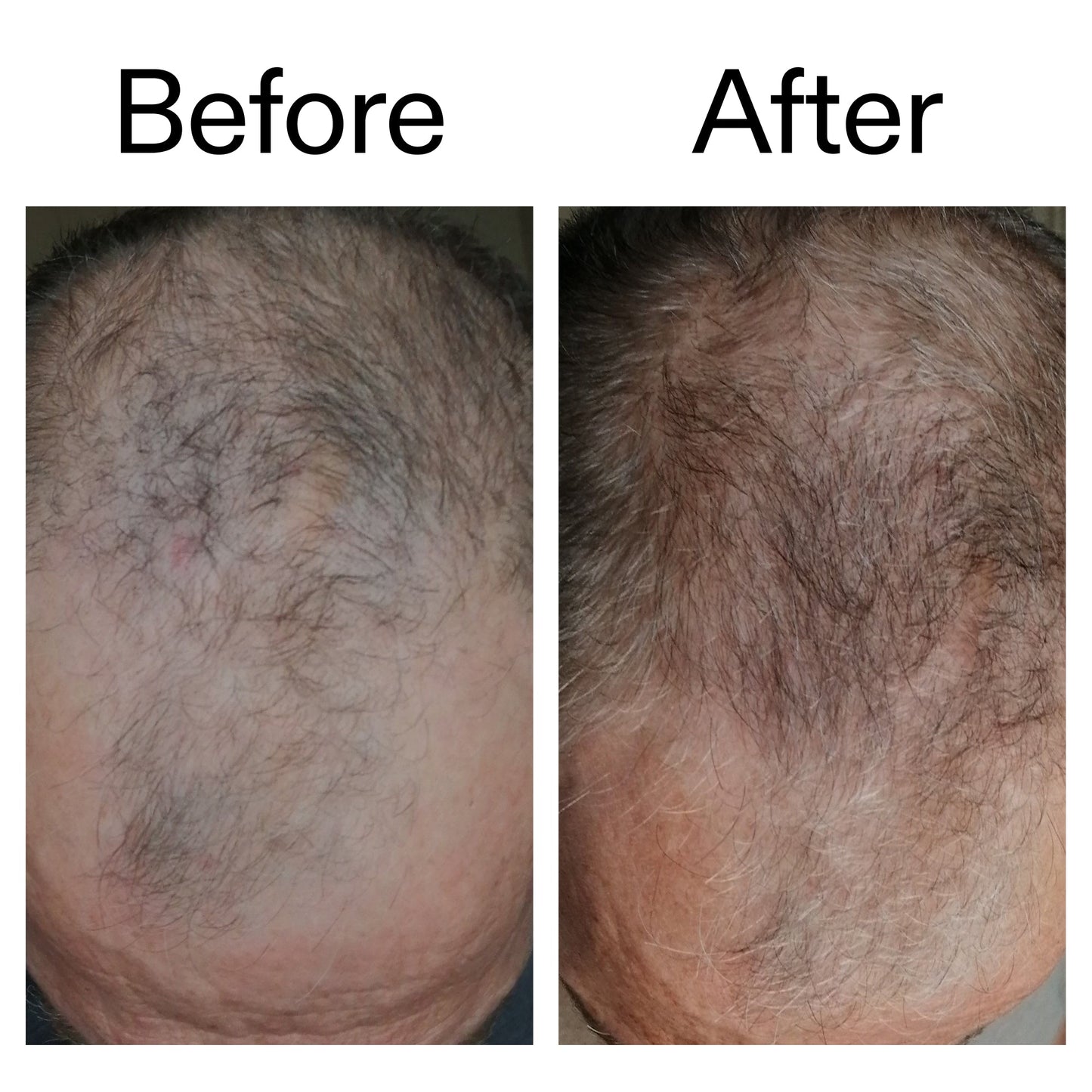 caffeine-stimulating-scalp-treatment-j8 Caffeine_Scalp_Treatment_B_A_Ppage_2000_x_2000.jpg