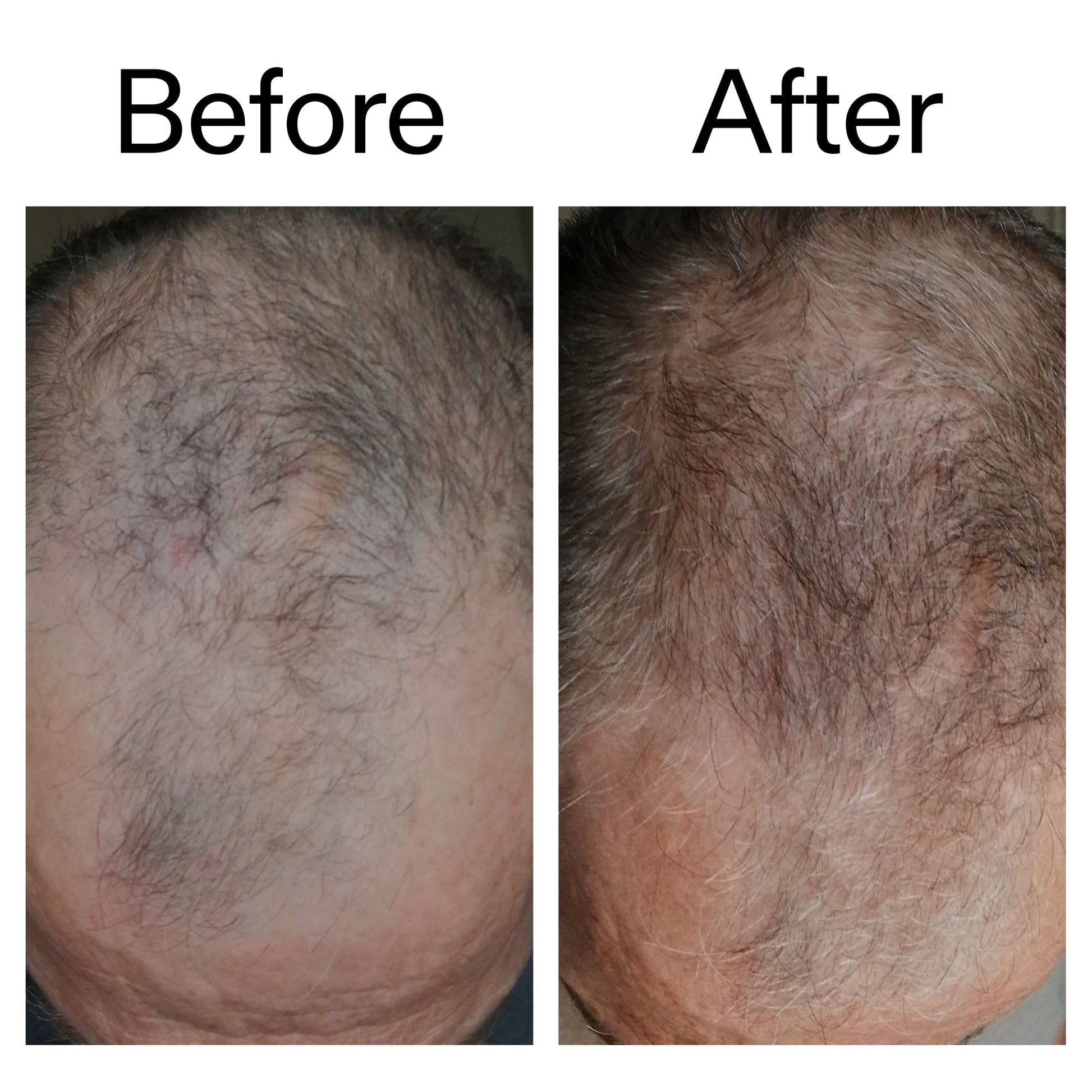 caffeine-stimulating-scalp-treatment-j8 Caffeine_Scalp_Treatment_B_A_Ppage_2000_x_2000.jpg