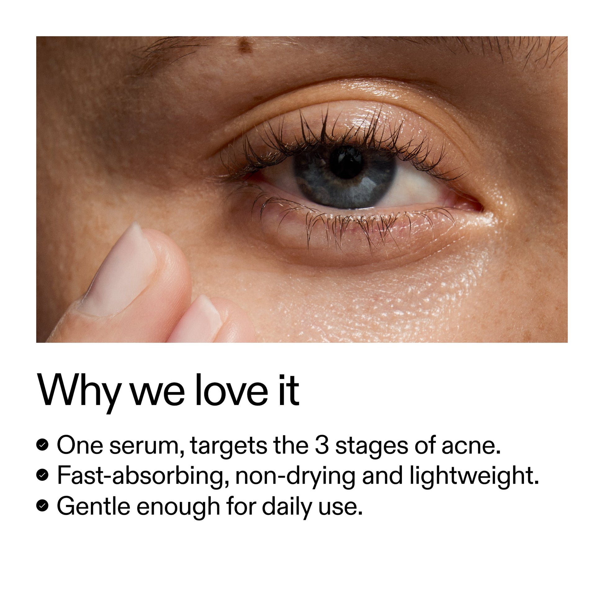 360-acne-clearing-serum-h1 Dioic_Whyweloveit_2000x2000_175aafd3-0cbe-403a-b317-a8362881bfe2.jpg