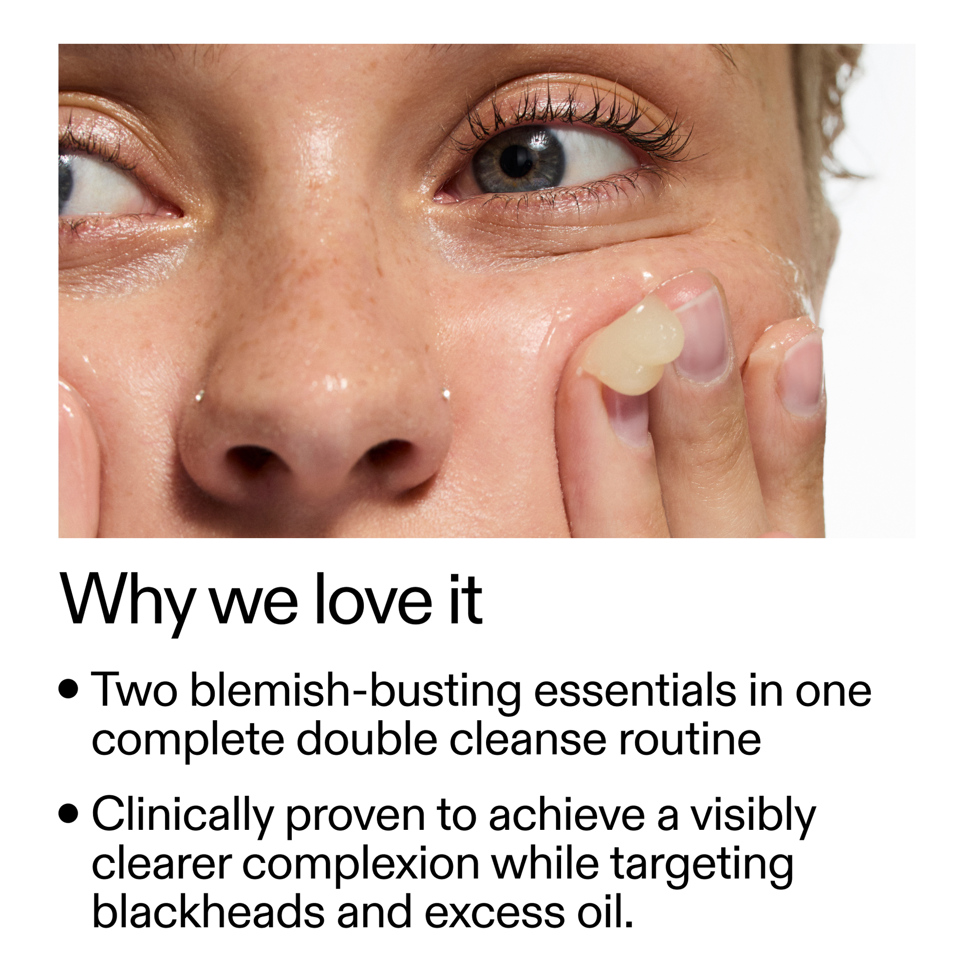 acne-double-cleanse-duo-a5 Double_Cleanse_Duo_for_Breakouts_Why_We_2000x2000_f242cb12-bb5c-487c-b203-071ccb406ec5.png