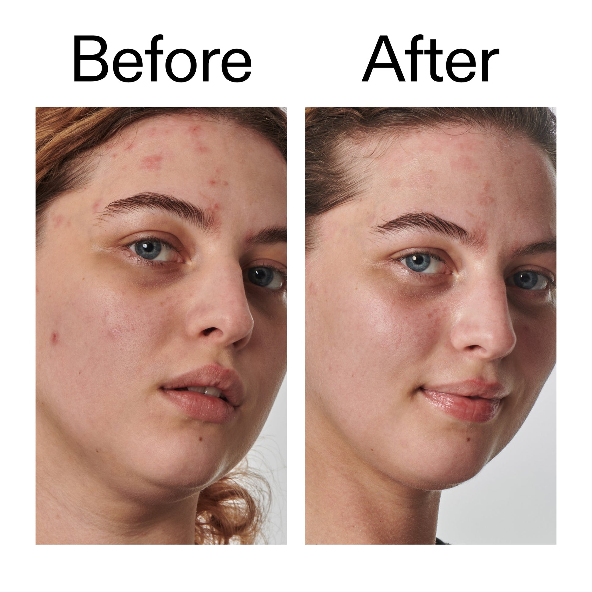10-urea-moisturizer-m9 Dry_and_Rough_Skin_Solution_Before_After_2000x2000_efa6e639-5c39-49bd-a5dd-f0220293120a.jpg