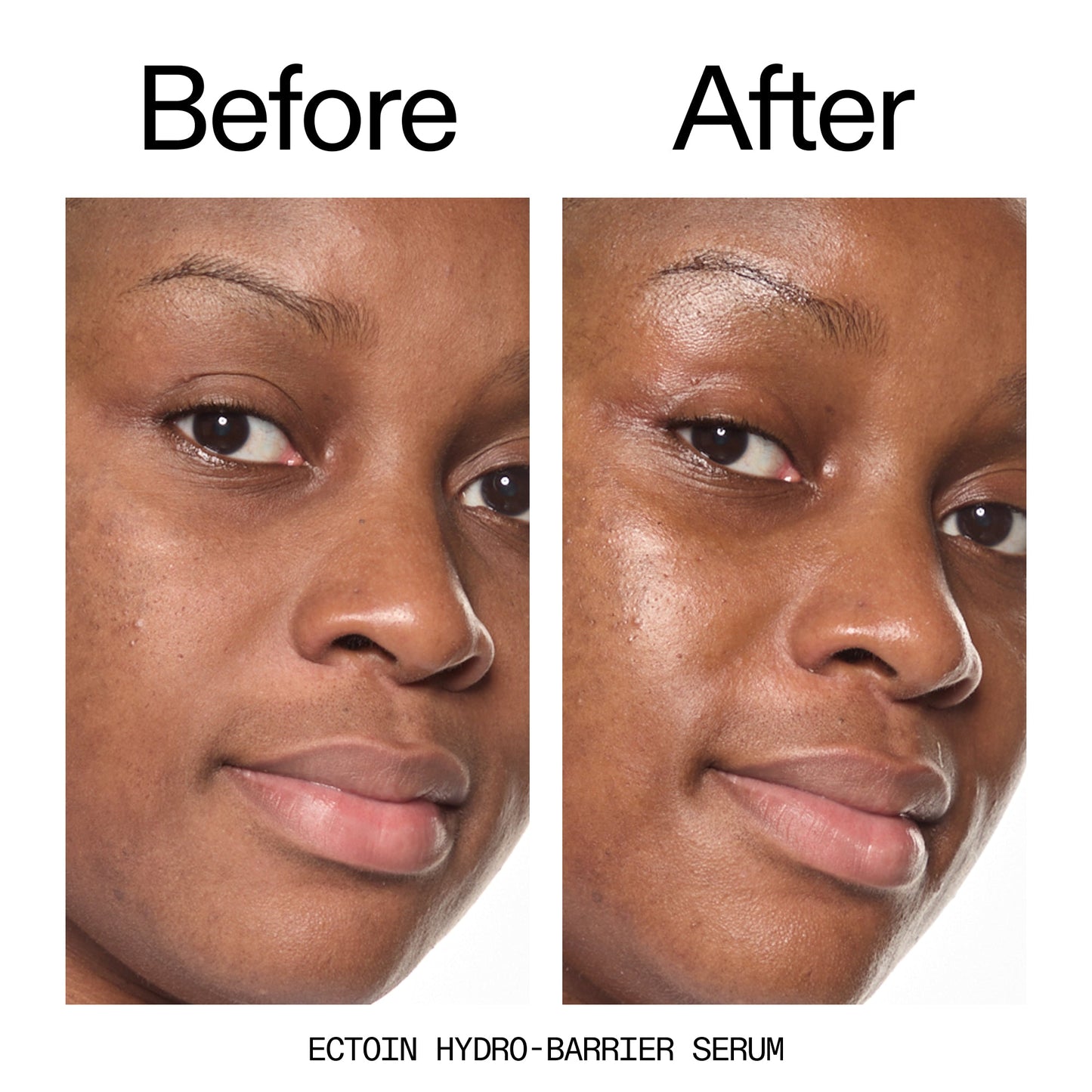barrier-boosting-trio-f9 Ectoin_Before_After_2000x2000_ce35bc41-4da0-4b6f-adc7-29f8641f6c6c.jpg