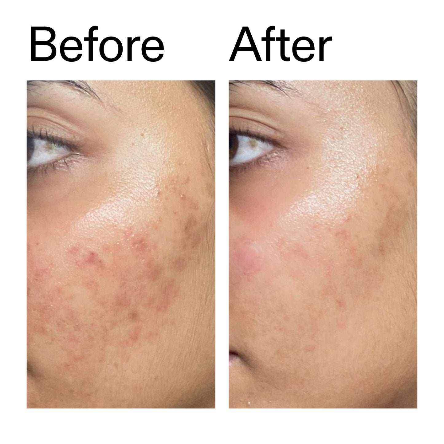 ectoin-hydro-barrier-serum-o1 Ectoin_Hydro-barrier_Serum__Before_After_2000x2000_34261920-d004-48d0-9c7b-8e1c15971bfd.jpg