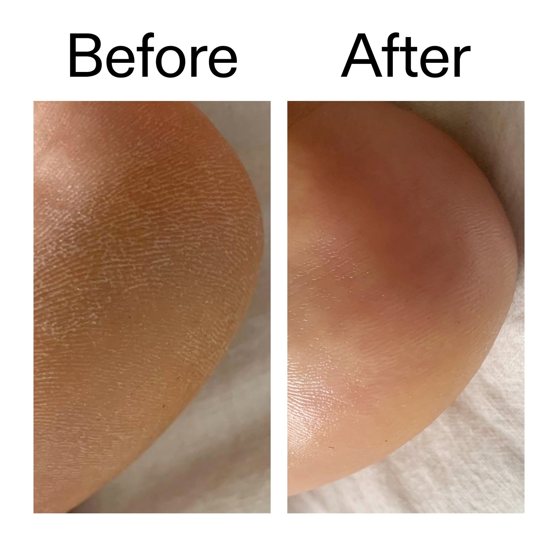 glycolic-acid-exfoliating-body-stick-d6 Glycolic_Acid_Exfoliating_Body_Stick_Before_After_V1_2000x2000_a3043625-9400-429a-a7fb-d6dbd220f722.jpg