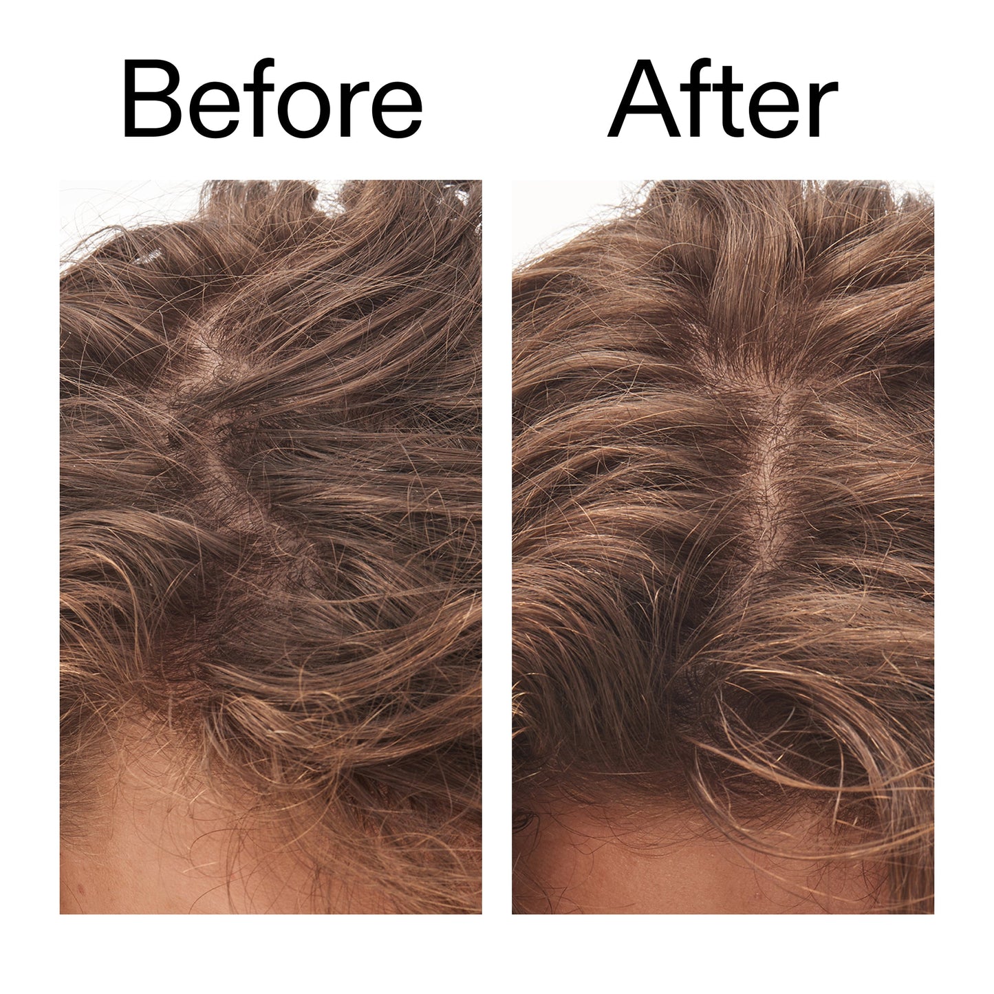 glycolic-acid-exfoliating-scalp-scrub-i9 Glycolic_Acid_Exfoliating_Scalp_Scrub_Before_After_2000x2000_b8561c87-05a1-4caa-80f7-1b6b33d750f7.jpg