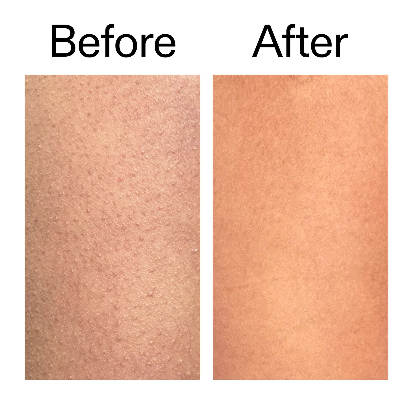 glycolic-acid-exfoliating-body-stick-d6 Glycolic_Body_Stick_B_A_2000x2000_6e6e6b4d-5bd7-43c0-aeed-4d66788e8995.jpg