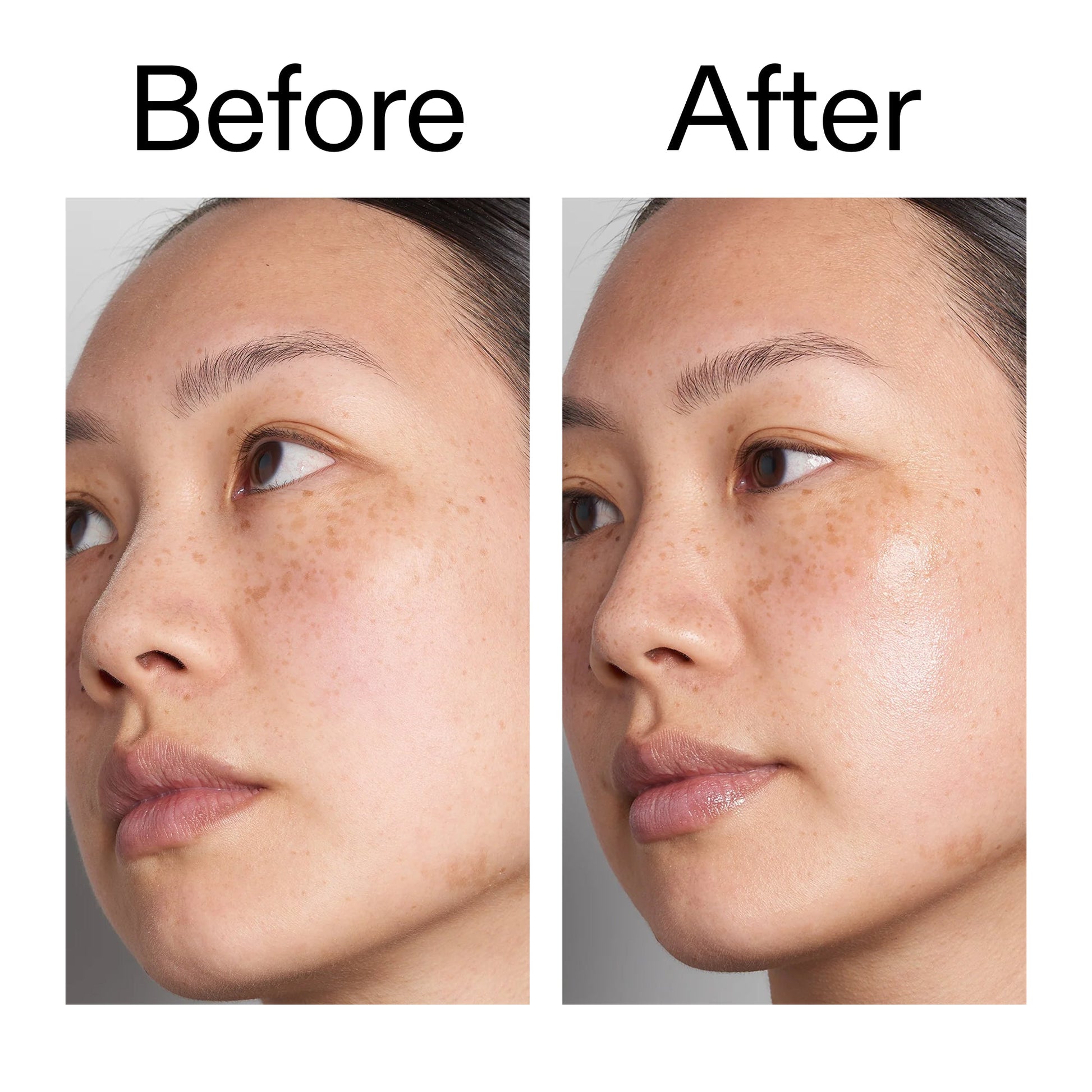 hyaluronic-acid-serum-60ml-p7 Hyaluronic_Acid_Before_After_2000x2000_d7983956-8aa2-4ea3-8255-c63e8d4f892e.jpg