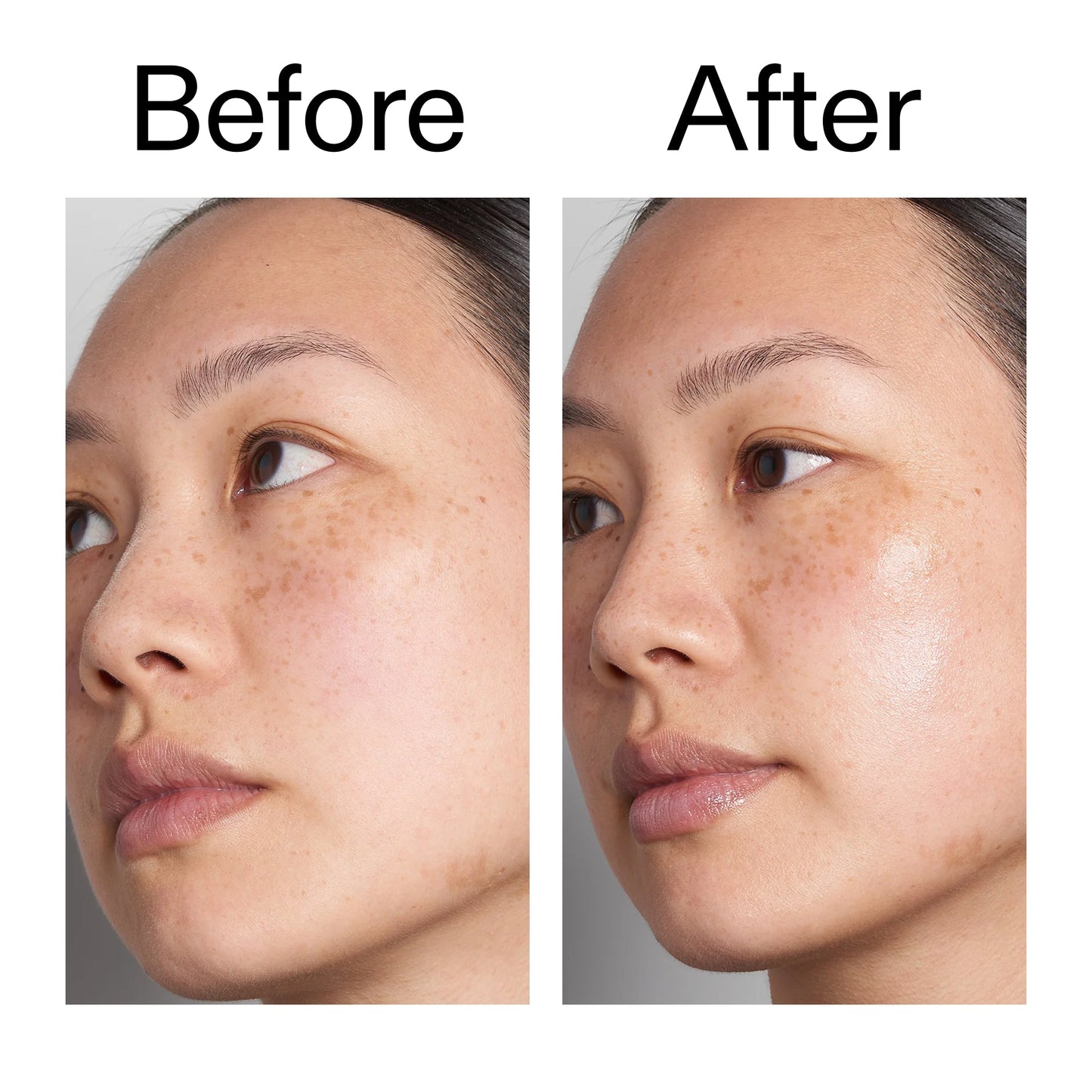 supersize-hyaluronic-acid-serum-100ml-u5 Hyaluronic_Acid_Before_After_2000x2000_d7983956-8aa2-4ea3-8255-c63e8d4f892e.jpg