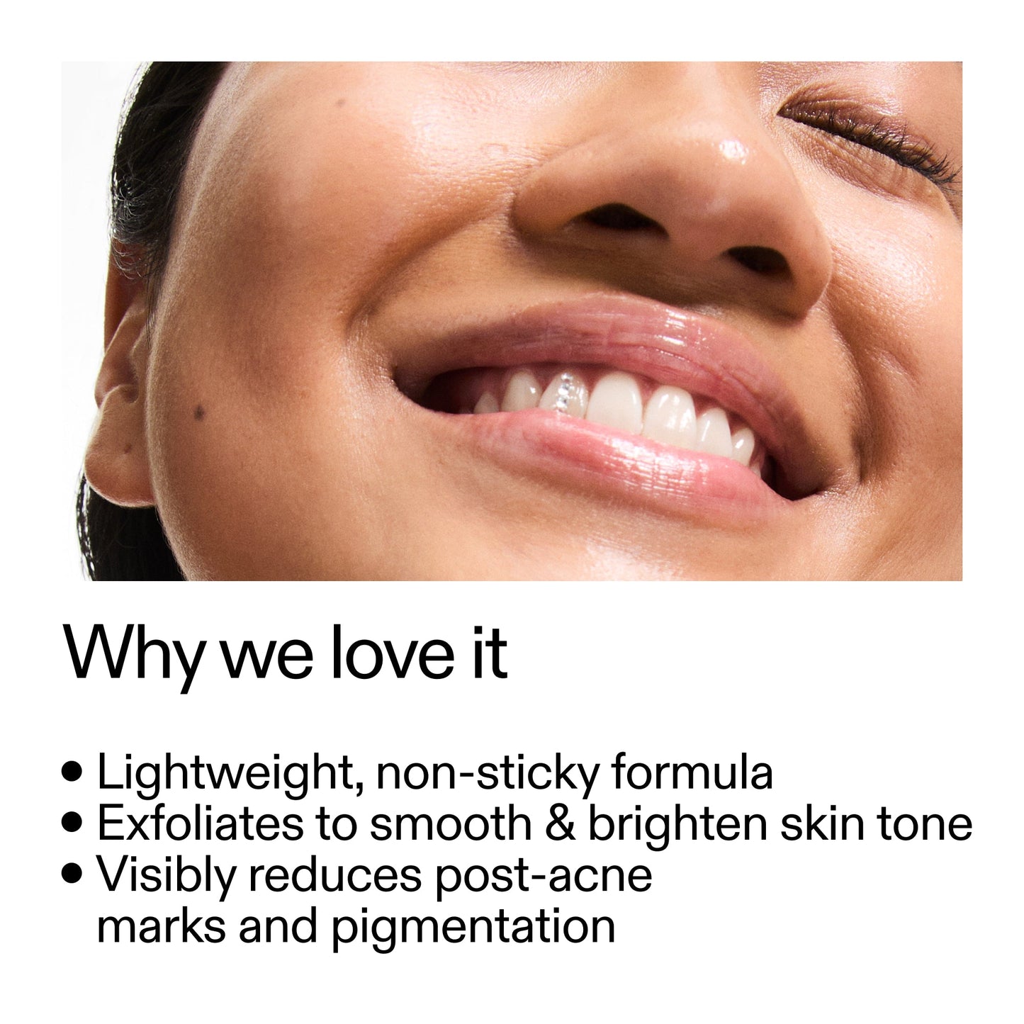 mandelic-acid-treatment-p6 Mandelic_Acid_Treatment_Why_we_love_it_2000x2000_6dfe29a9-2a79-464f-a5e8-e5ac37d93388.jpg