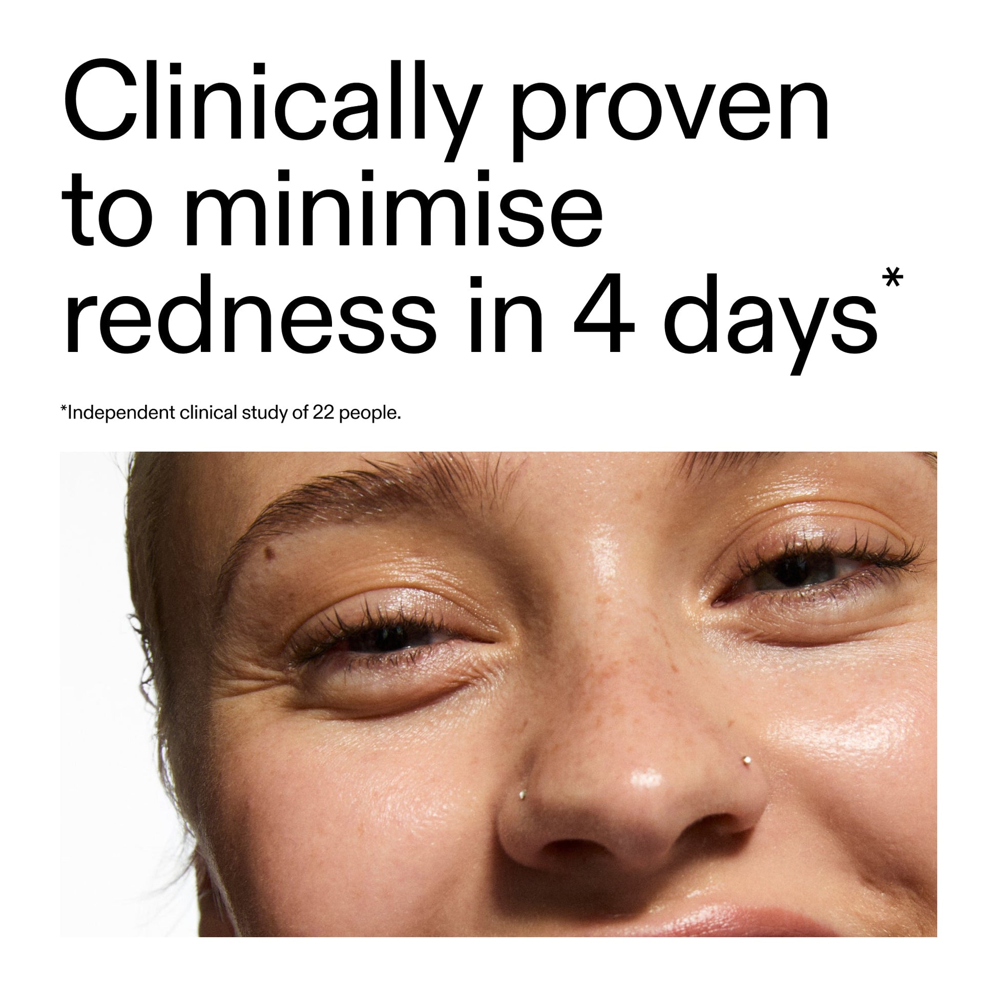 10-azelaic-acid-serum-for-redness-relief-v8 Oat_Cleansing_Balm_Claim_2000x2000_52a841dc-353c-4f2c-8646-3aadb604507d.jpg