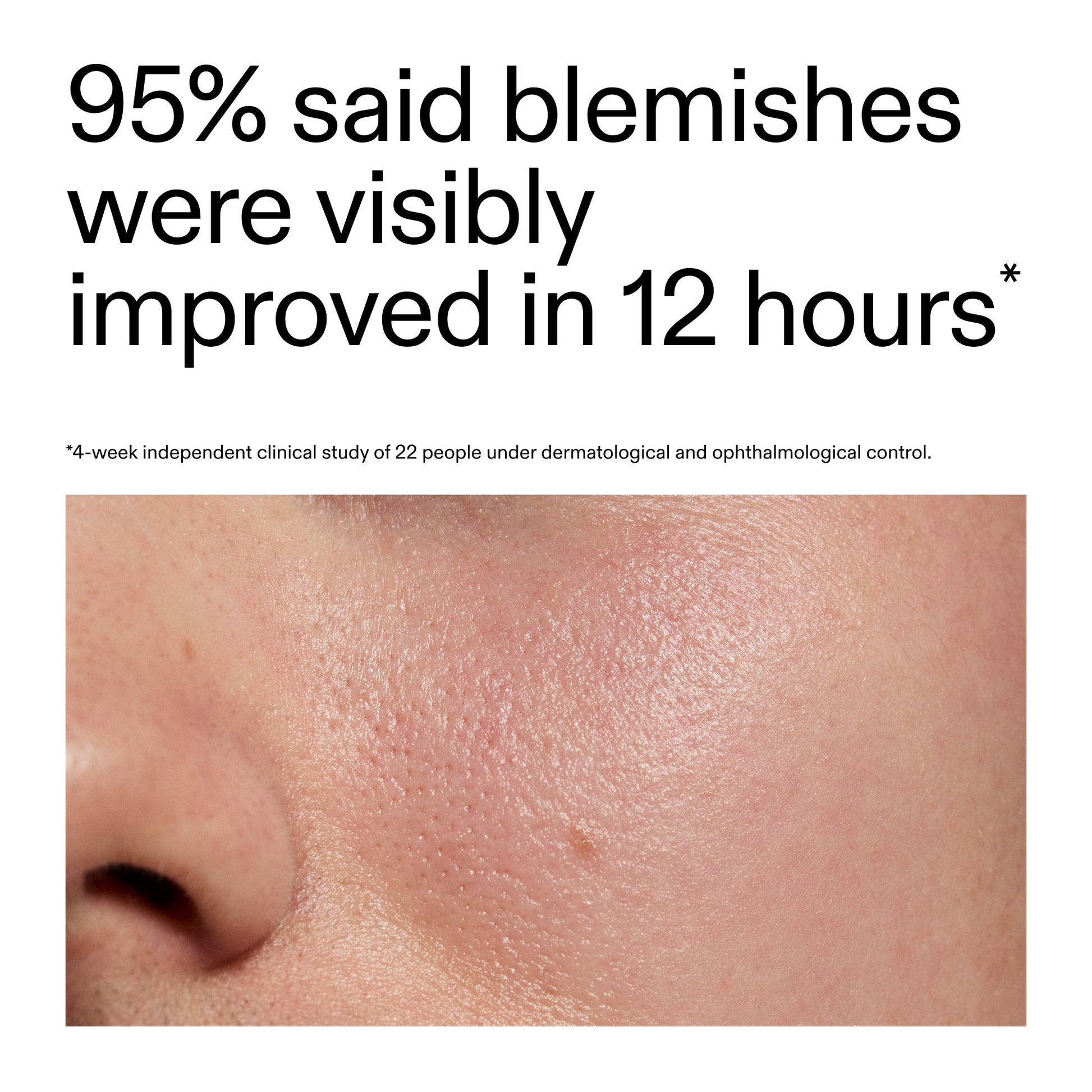 succinic-acid-acne-treatment-b6 Oat_Cleansing_Balm_Claim_2000x2000_ac6ce553-25db-41b2-a981-faae1ac4b8c0.jpg