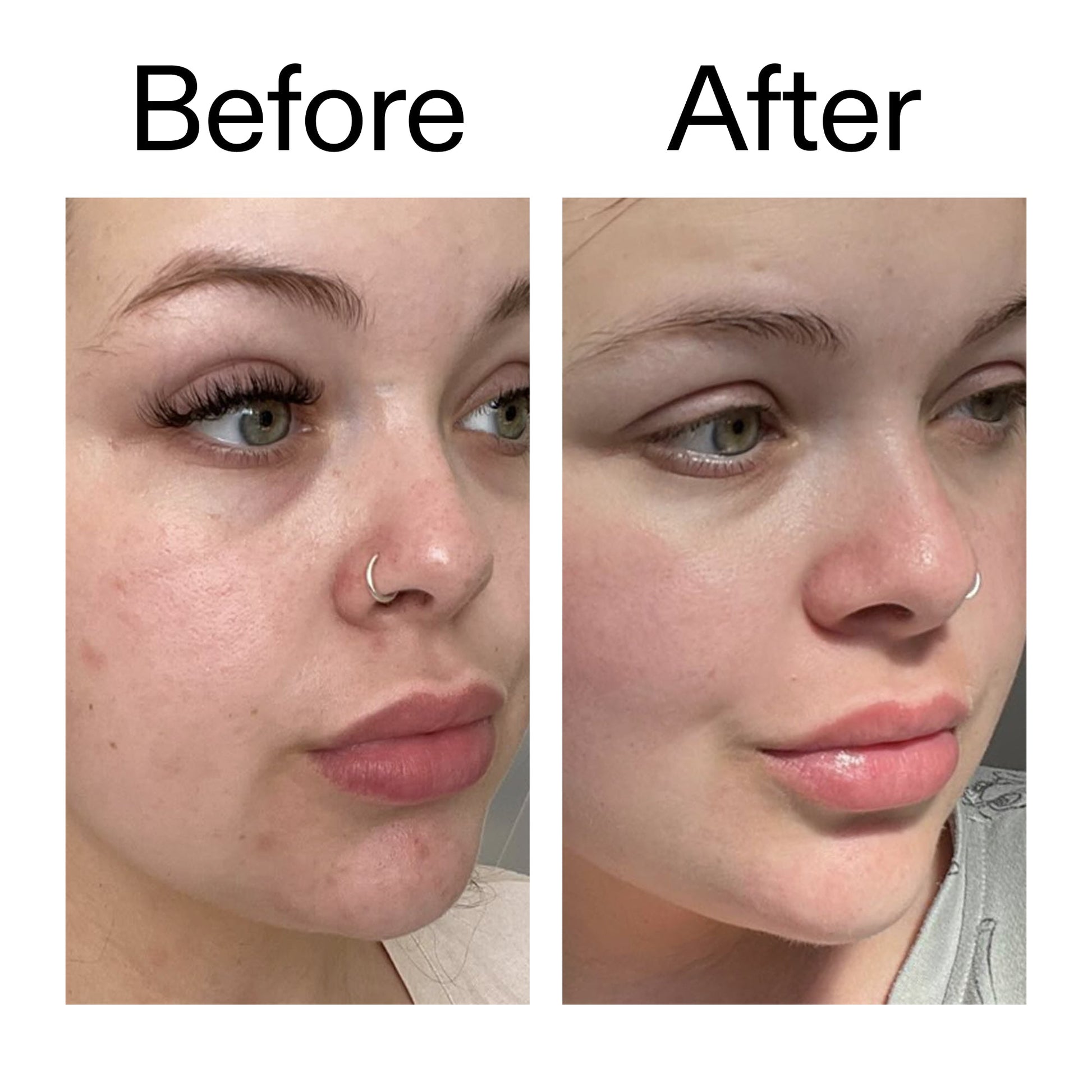 supersize-omega-water-cream-duo-b1 Omega50_Before_After_2000x2000_46483ed8-3f9d-487f-9a0c-9df79830bd65.jpg