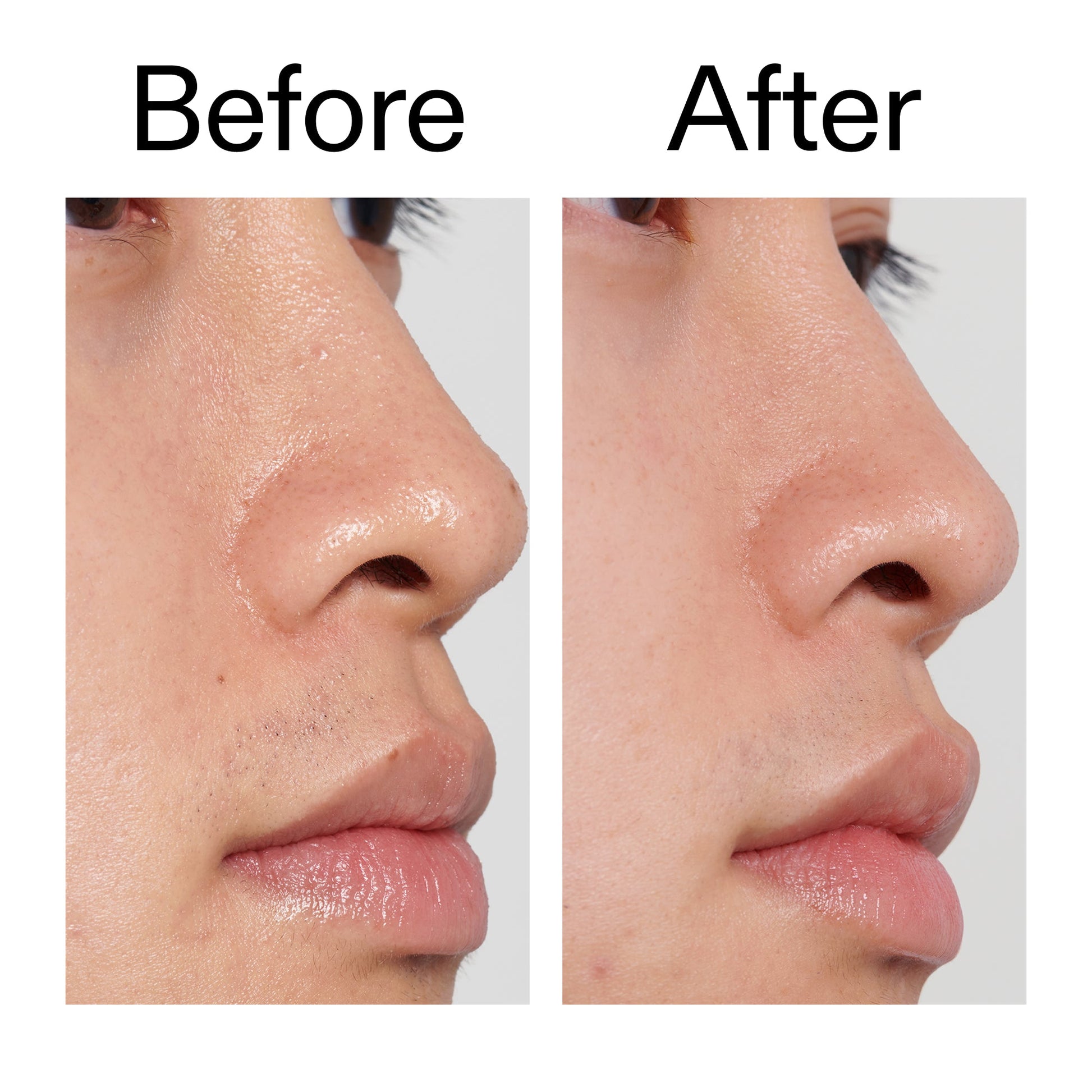 pha-toner-l5 PHA_Toner_Before_After_2000x2000_e3c10172-0150-4342-8b95-57417eaff50d.jpg