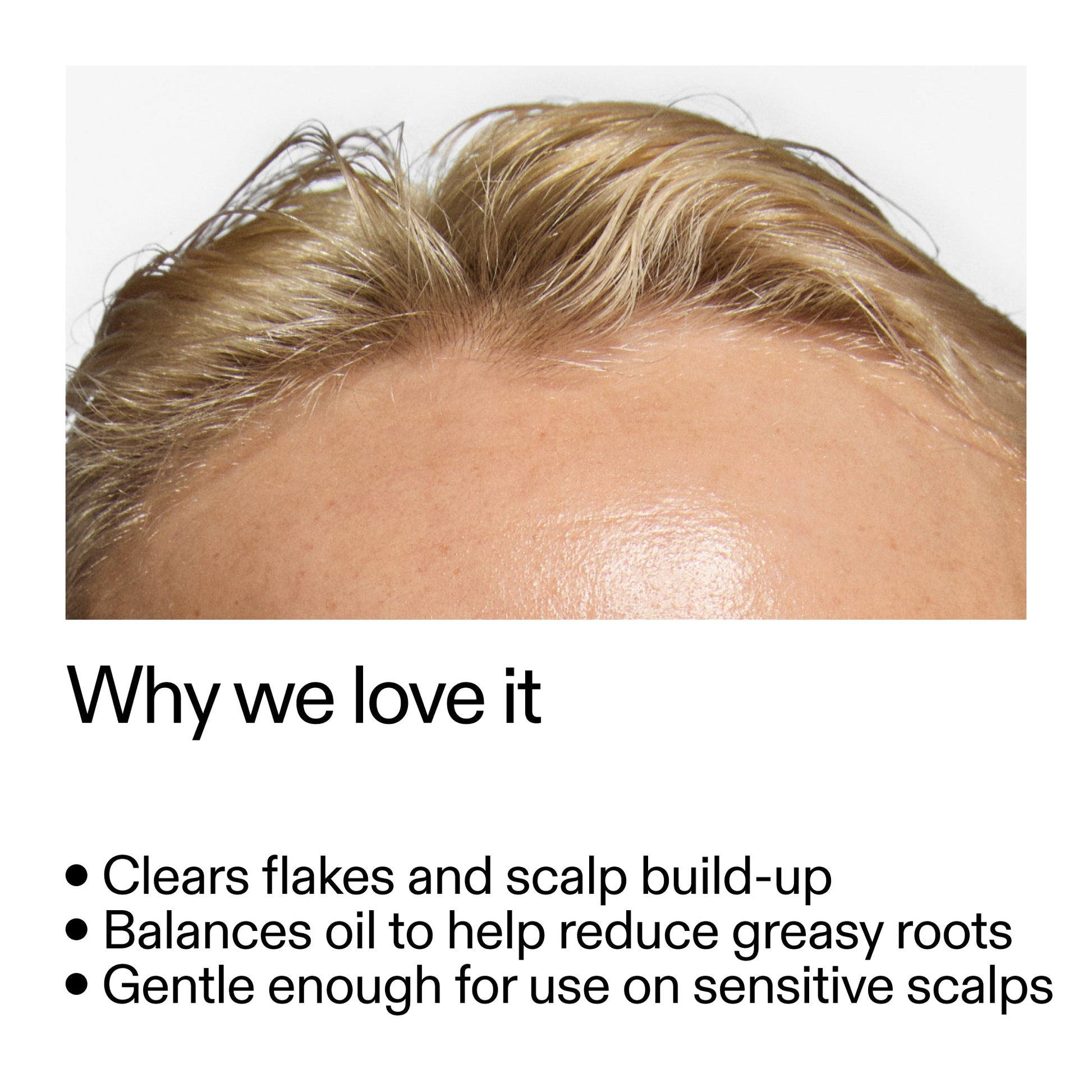 salicylic-acid-exfoliating-scalp-treatment-l7 Salicylic_Acid_Exfoliating_Scalp_Treatment_Why_we_love_it_2000x2000_44b6bd6d-9ec4-4b23-9dc4-bc3fd6f28e14.jpg