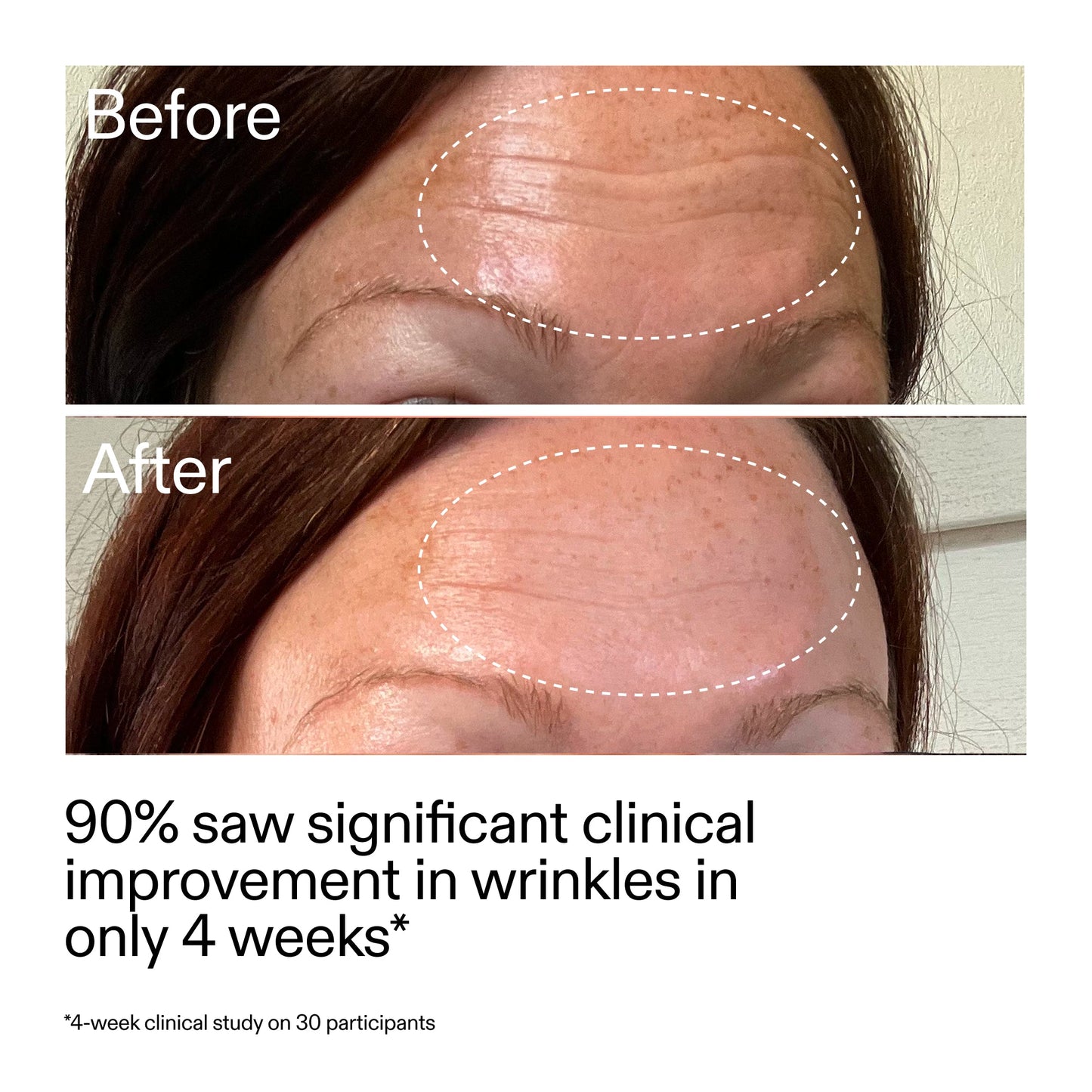 starter-retinol-serum-duo-s3 StarterRetinol_BeforeAfter_Claim1_2000x2000_03b4d6e5-a357-43b9-a855-aba5e35c57f3.jpg