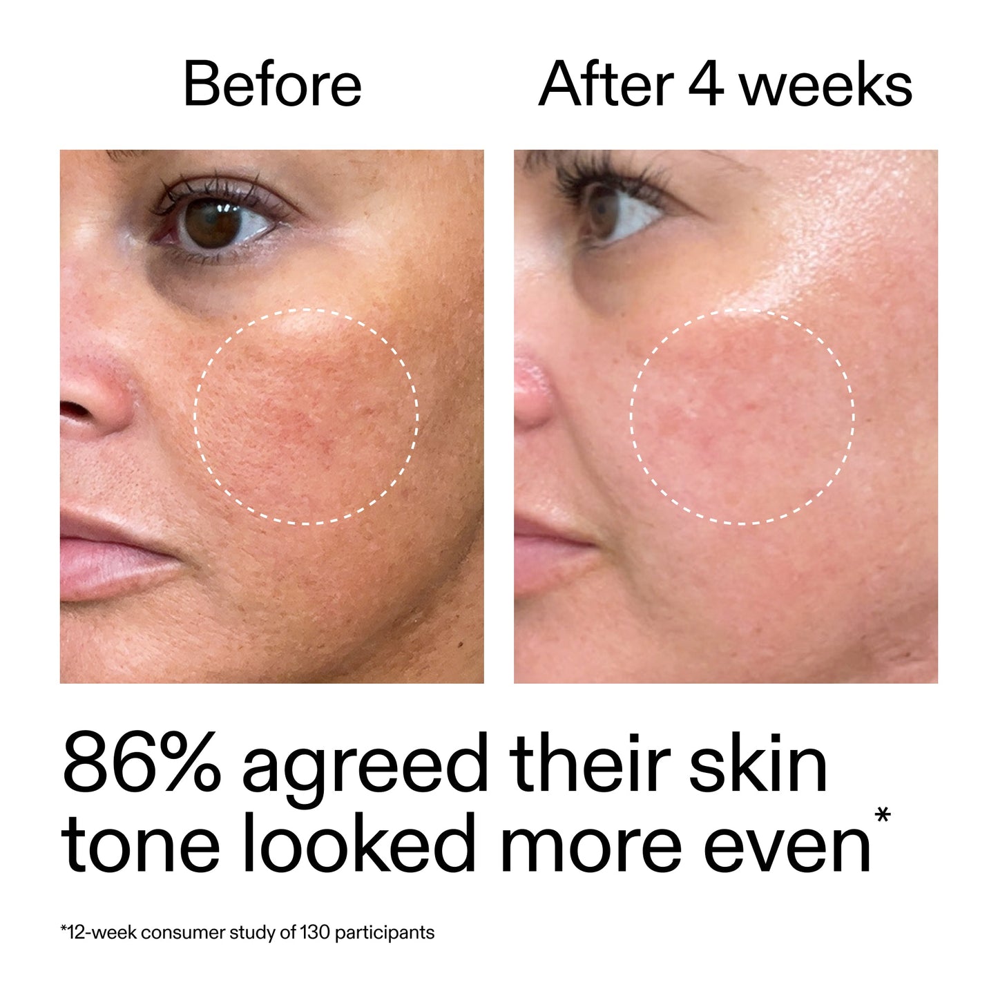 starter-retinol-serum-duo-s3 StarterRetinol_BeforeAfter_Claim2_2000x2000_fc5bb8ac-8588-478f-98d5-28af6651601a.jpg