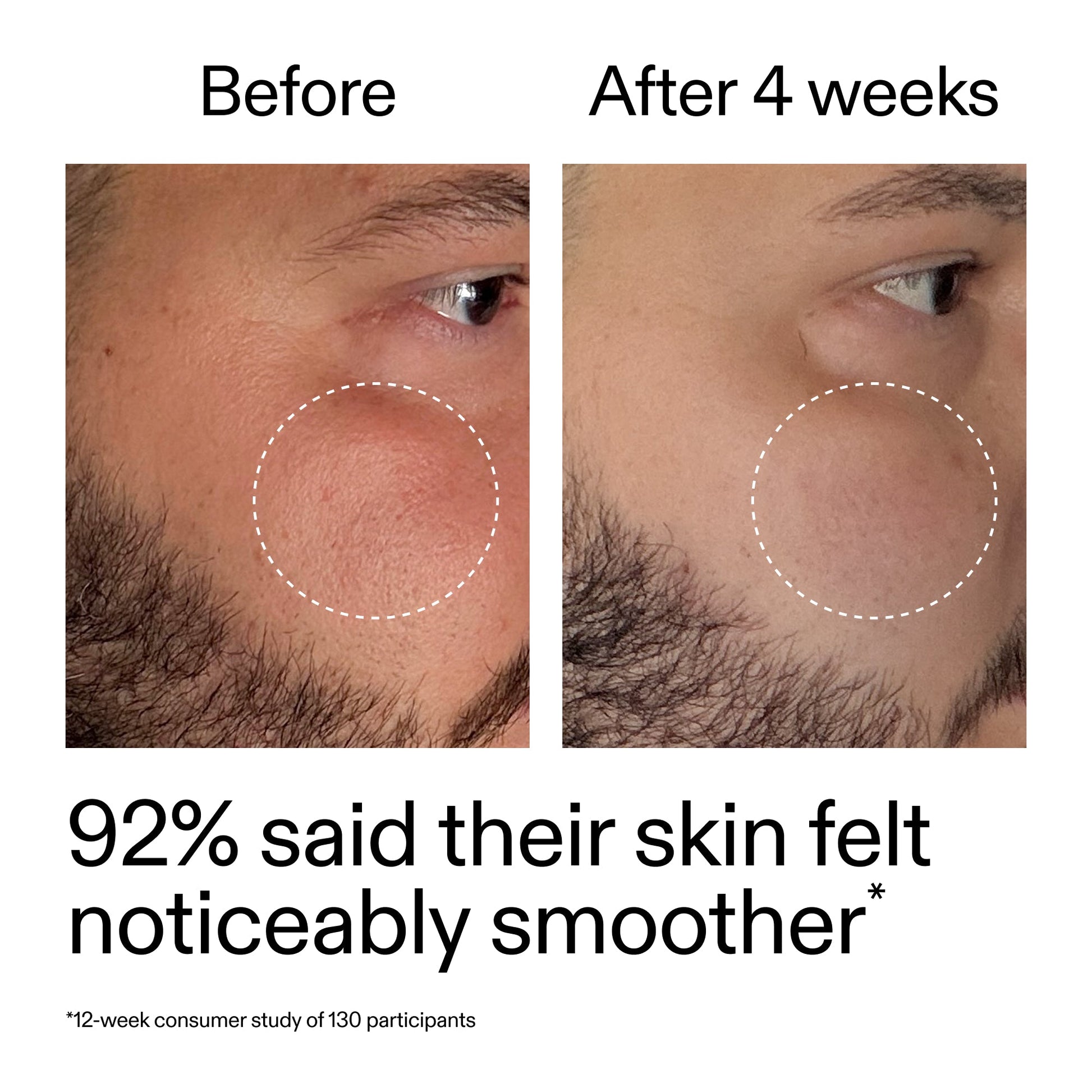 starter-retinol-serum-duo-s3 StarterRetinol_BeforeAfter_Claim3_2000x2000_458243a8-bbb0-4e5d-a274-29c7766d339b.jpg