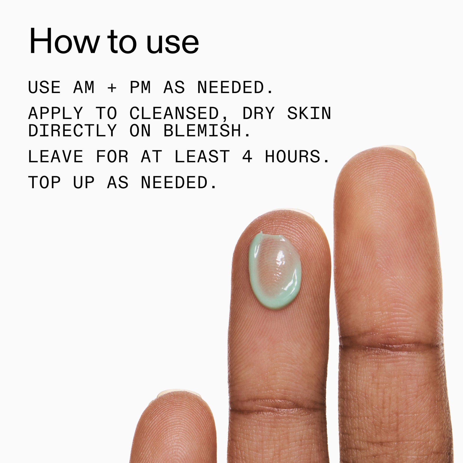 succinic-acid-acne-treatment-b6 Succinic_Acid_Treatment_How_to_Use_2000x2000_d57137d5-d7f1-427c-9a46-5fc00c19c542.jpg