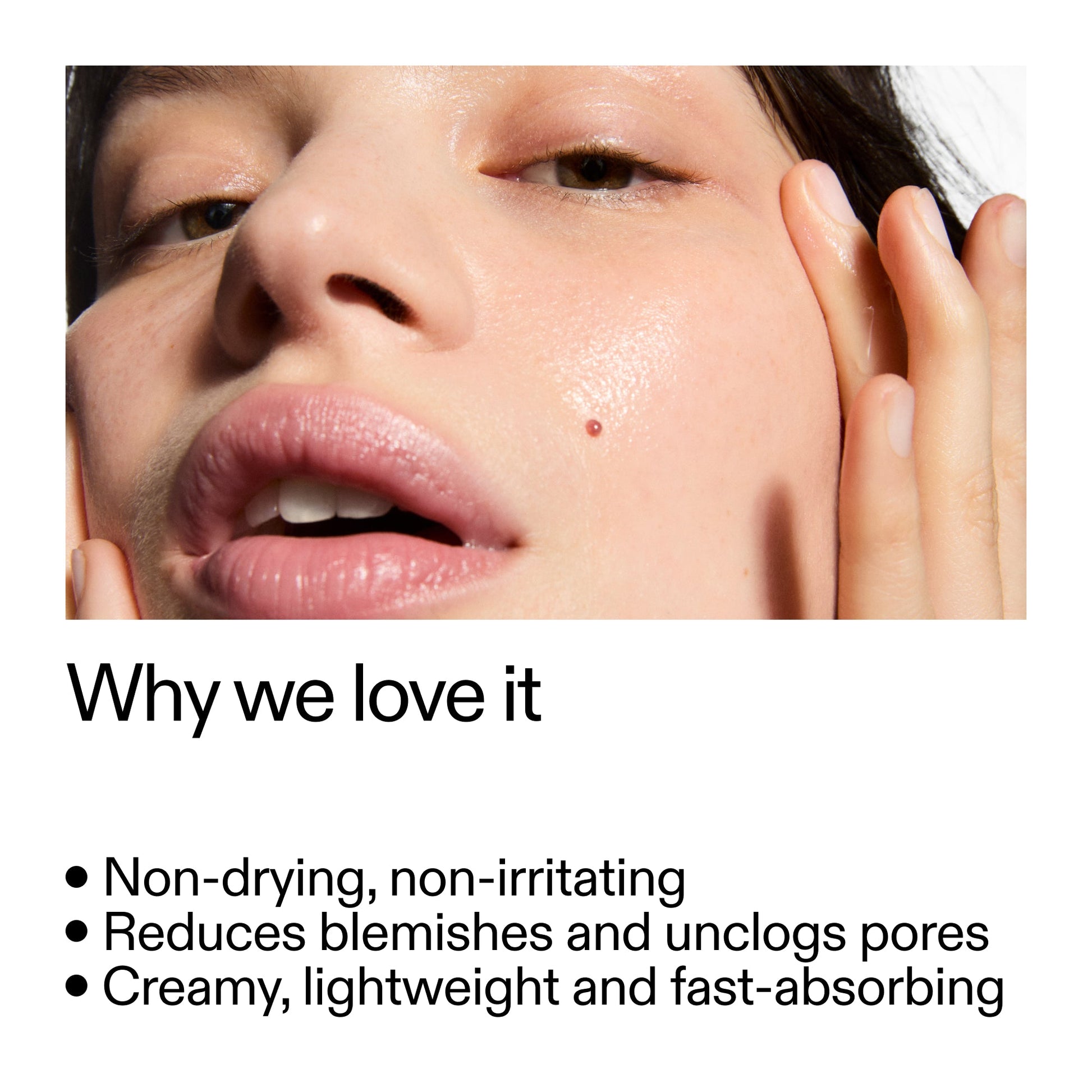 succinic-acid-acne-treatment-b6 Succinic_Acid_Treatment_Why_we_love_it_2000x2000_e90dd42a-cfe9-48b5-a2c7-d5eda787a6a8.jpg