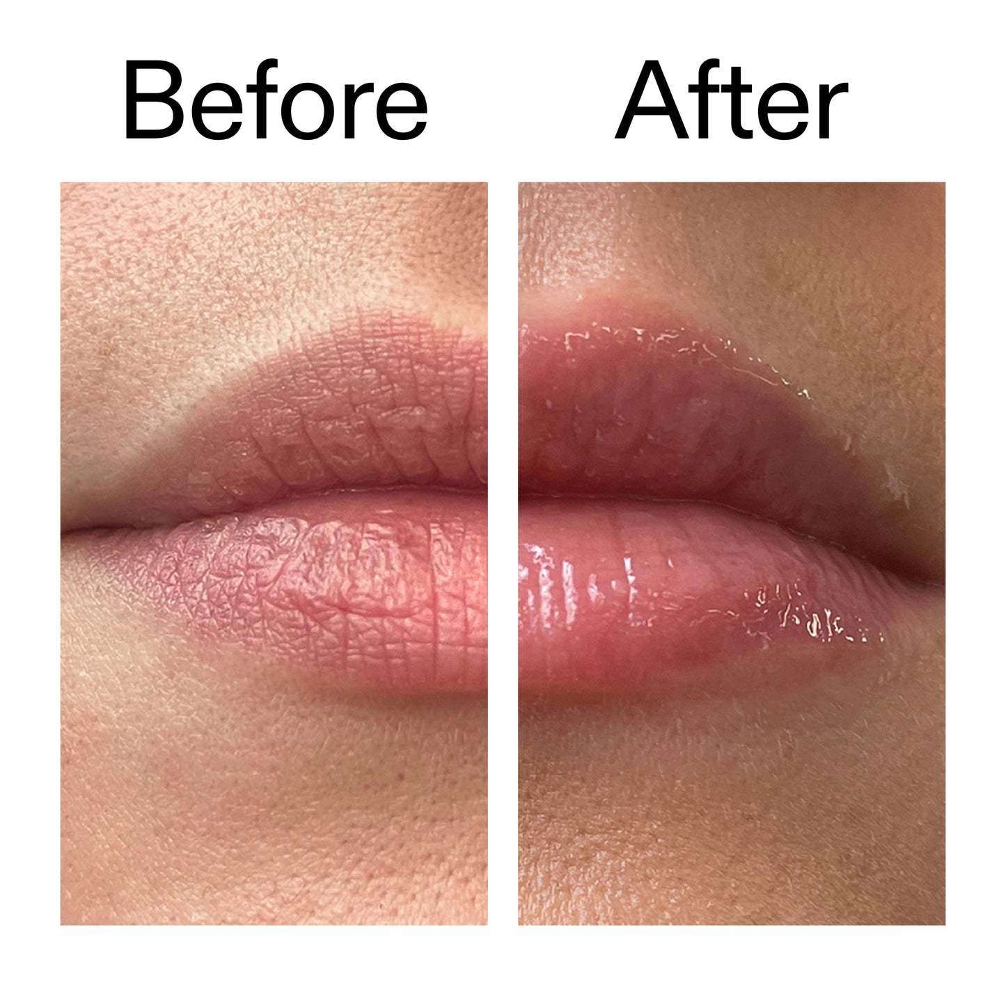 tripeptide-plumping-lip-balm-a8 Tripeptide_Plumping_Lip_Balm_Before_After_2000x2000_b4a5ee04-d2ac-4857-8f01-17209acc4bf3.jpg