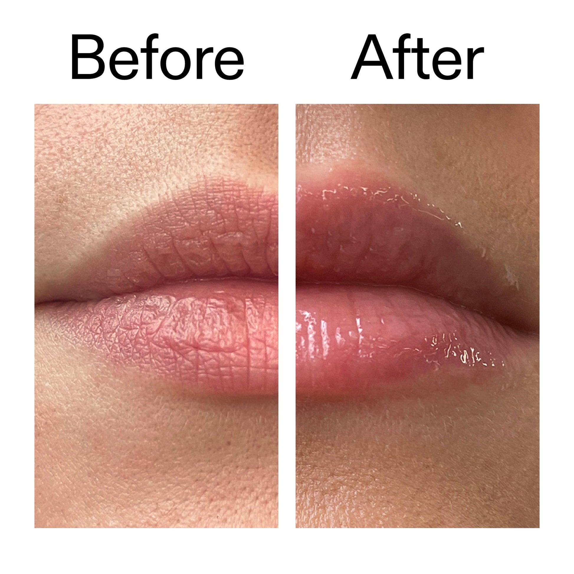 tripeptide-plumping-lip-balm-a8 Tripeptide_Plumping_Lip_Balm_Before_After_2000x2000_b4a5ee04-d2ac-4857-8f01-17209acc4bf3.jpg