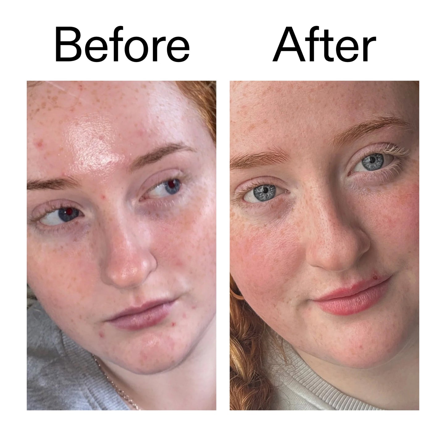 vitamin-b-c-and-e-moisturizer-p8 Vitamin_B_C_and_E_Moisturizer_Before_After_2000x2000_b0781a76-5ad2-4be9-95b8-ef92b356833c.jpg